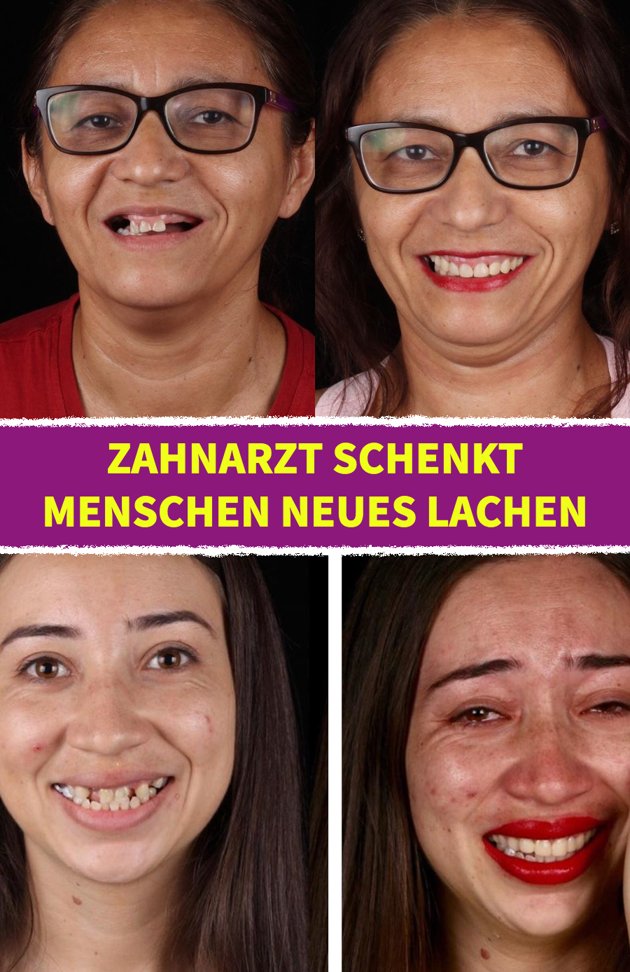 16 Vorher-nachher-Bilder von Menschen mit neuen Zähnen