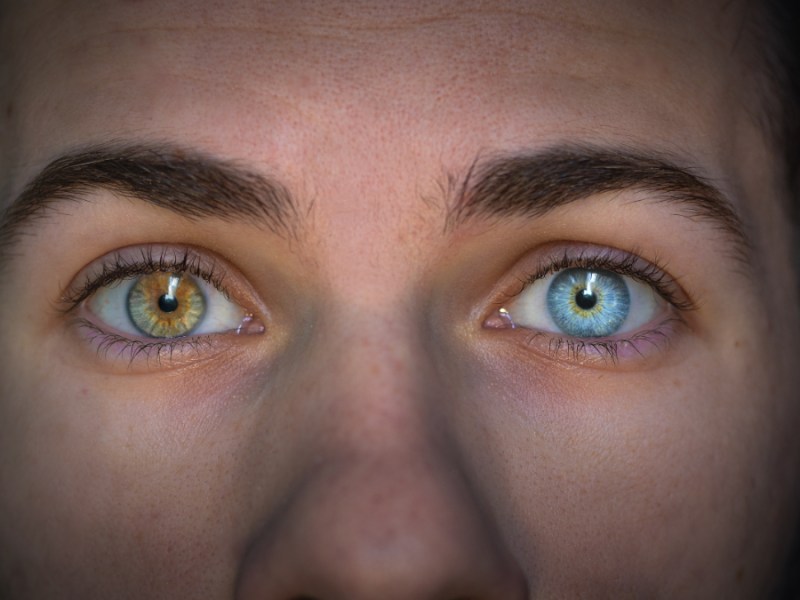 Ein Porträt von einem Menschen mit Heterochromie.