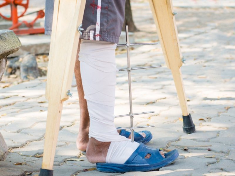 Ein Mann in Gips und Krücken in einem Park.