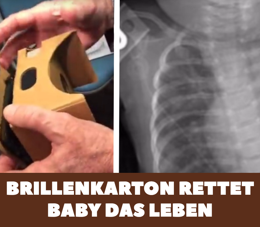 Operation: Brillenkarton rettet Baby das Leben